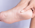 cara mengatasi kaki pecah pecah